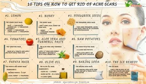 boni scars|How to get rid of acne scars: your ultimate guide